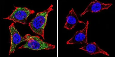 Anti-Vimentin antibody [J144] used in Immunocytochemistry/ Immunofluorescence (ICC/IF). GTX80814