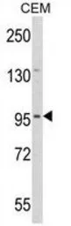 Anti-DZIP1 antibody, Internal used in Western Blot (WB). GTX80938