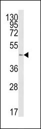 Anti-B4GALT1 antibody, C-term used in Western Blot (WB). GTX80958