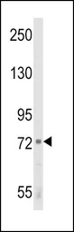 Anti-ALOX12 antibody, C-term used in Western Blot (WB). GTX80966