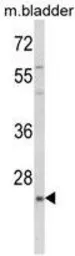 Anti-KLF16 antibody, Internal used in Western Blot (WB). GTX80982