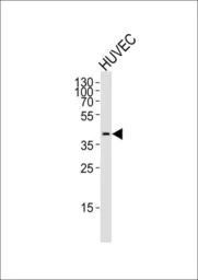 Anti-OLR1 / LOX-1 antibody, Internal used in Western Blot (WB). GTX80987