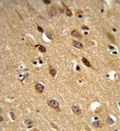 Anti-PISD antibody, Internal used in IHC (Paraffin sections) (IHC-P). GTX80997