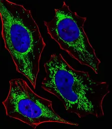 Anti-Glutaminase antibody, C-term used in Immunocytochemistry/ Immunofluorescence (ICC/IF). GTX81012