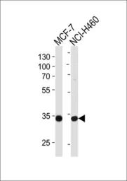 Anti-Tafazzin / TAZ antibody, N-term used in Western Blot (WB). GTX81015
