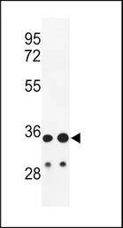 Anti-IGH antibody, C-term used in Western Blot (WB). GTX81028