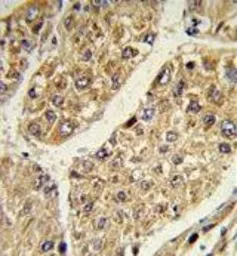 Anti-CSGALNACT2 antibody, Internal used in IHC (Paraffin sections) (IHC-P). GTX81034