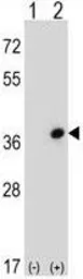 Anti-CDC42EP3 antibody, N-term used in Western Blot (WB). GTX81035