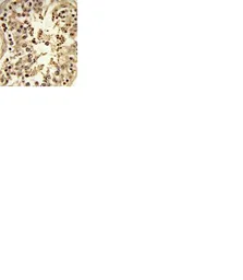 Anti-TRP2 antibody, N-term used in IHC (Paraffin sections) (IHC-P). GTX81039