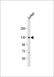 Anti-SREBP1 antibody, Internal used in Western Blot (WB). GTX81061