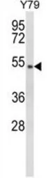 Anti-GTF2H4 antibody, Internal used in Western Blot (WB). GTX81063