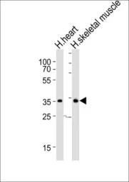 Anti-DIO2 antibody, Internal used in Western Blot (WB). GTX81072