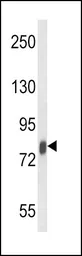 Anti-Lactoferrin antibody used in Western Blot (WB). GTX81085