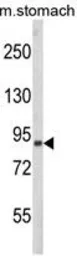 Anti-PARD3 antibody, C-term used in Western Blot (WB). GTX81098