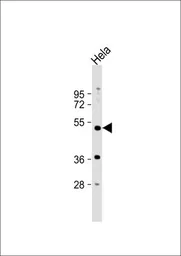 Anti-PXR antibody, Internal used in Western Blot (WB). GTX81102