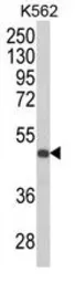 Anti-KIR3DS1 antibody, C-term used in Western Blot (WB). GTX81103