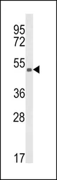 Anti-KMO antibody, Internal used in Western Blot (WB). GTX81111