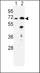 Anti-EHHADH antibody, C-term used in Western Blot (WB). GTX81126