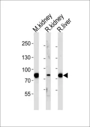 Anti-EHHADH antibody, C-term used in Western Blot (WB). GTX81126