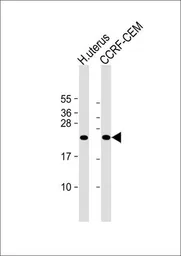 Anti-NKG2C antibody, N-term used in Western Blot (WB). GTX81130