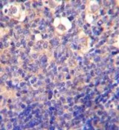 Anti-NKG2C antibody, N-term used in IHC (Paraffin sections) (IHC-P). GTX81130