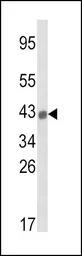 Anti-HLA-B antibody, N-term used in Western Blot (WB). GTX81138