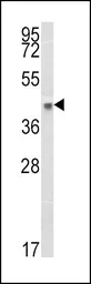 Anti-HLA-B antibody, N-term used in Western Blot (WB). GTX81138