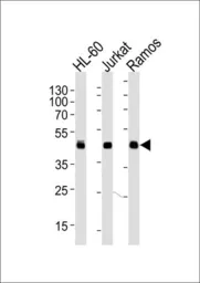 Anti-HLA-B antibody, N-term used in Western Blot (WB). GTX81138