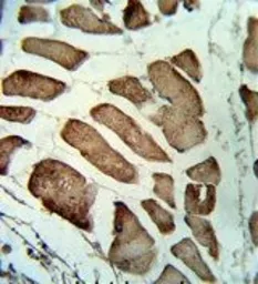 Anti-LMOD1 antibody, Internal used in IHC (Paraffin sections) (IHC-P). GTX81141