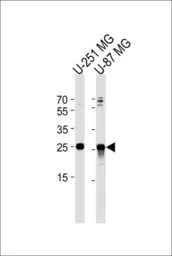 Anti-VTI1A antibody, C-term used in Western Blot (WB). GTX81147