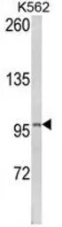Anti-Lipin 2 antibody, Internal used in Western Blot (WB). GTX81160