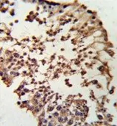 Anti-Rb antibody, C-term used in IHC (Paraffin sections) (IHC-P). GTX81164