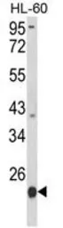 Anti-LMP2 antibody, C-term used in Western Blot (WB). GTX81175