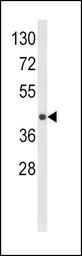 Anti-HLA-E antibody, Internal used in Western Blot (WB). GTX81202