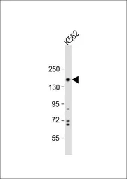 Anti-PHLPP1 antibody, N-term used in Western Blot (WB). GTX81275