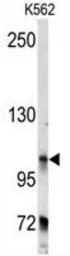 Anti-BICD2 antibody, C-term used in Western Blot (WB). GTX81309