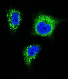 Anti-TrkA antibody used in Immunocytochemistry/ Immunofluorescence (ICC/IF). GTX81329
