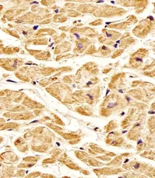 Anti-ROR1 antibody used in IHC (Paraffin sections) (IHC-P). GTX81334