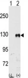 Anti-EphB1 antibody used in Western Blot (WB). GTX81349