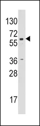 Anti-Aromatase antibody, C-term used in Western Blot (WB). GTX81387