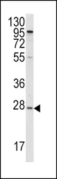 Anti-Apolipoprotein A1 antibody, N-term used in Western Blot (WB). GTX81467