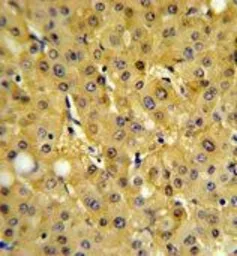 Anti-FBP1 antibody, Internal used in IHC (Paraffin sections) (IHC-P). GTX81482
