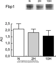 Anti-FBP1 antibody, Internal used in Western Blot (WB). GTX81482