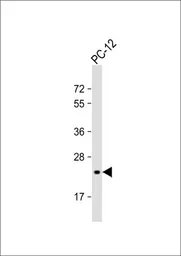 Anti-DHFR antibody, C-term used in Western Blot (WB). GTX81492