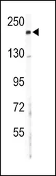 Anti-COL5A2 antibody, N-term used in Western Blot (WB). GTX81507