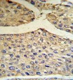 Anti-Factor B (Bb fragment) antibody, Internal used in IHC (Paraffin sections) (IHC-P). GTX81508