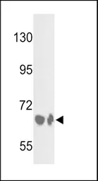 Anti-Factor B (Bb fragment) antibody, Internal used in Western Blot (WB). GTX81508