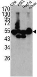 Anti-CPN1 antibody, N-term used in Western Blot (WB). GTX81518
