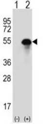 Anti-Carbonic Anhydrase 14 antibody, N-term used in Western Blot (WB). GTX81537
