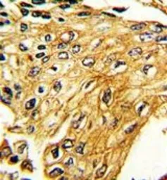 Anti-Interferon gamma Receptor 2 antibody, C-term used in IHC (Paraffin sections) (IHC-P). GTX81601